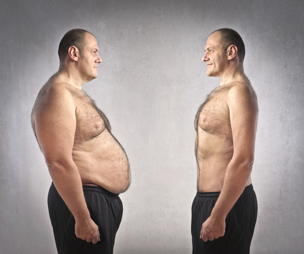 medically supervised weight loss