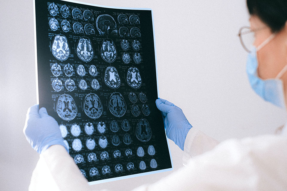 doctor reviewing MRI scans for dementia in women